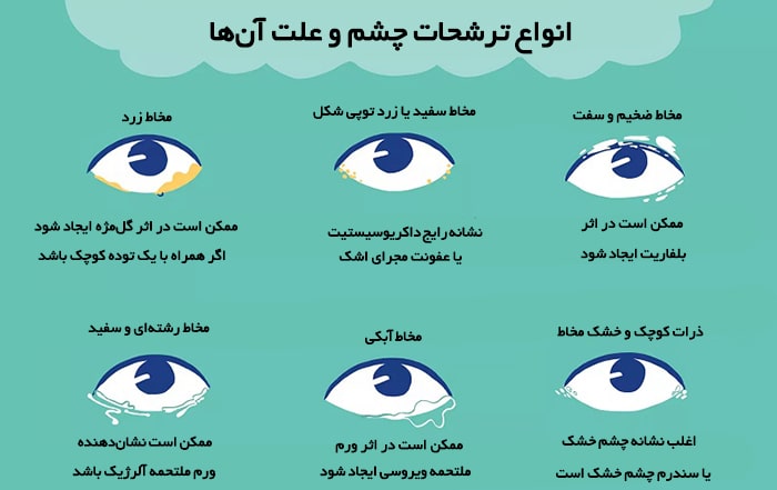 انواع ترشحات چشم و علت آن‌ها